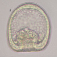 原腸胚